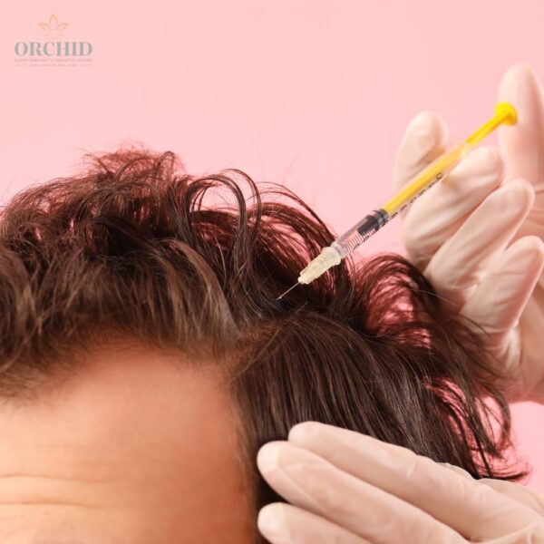 Hair Mesotherapy