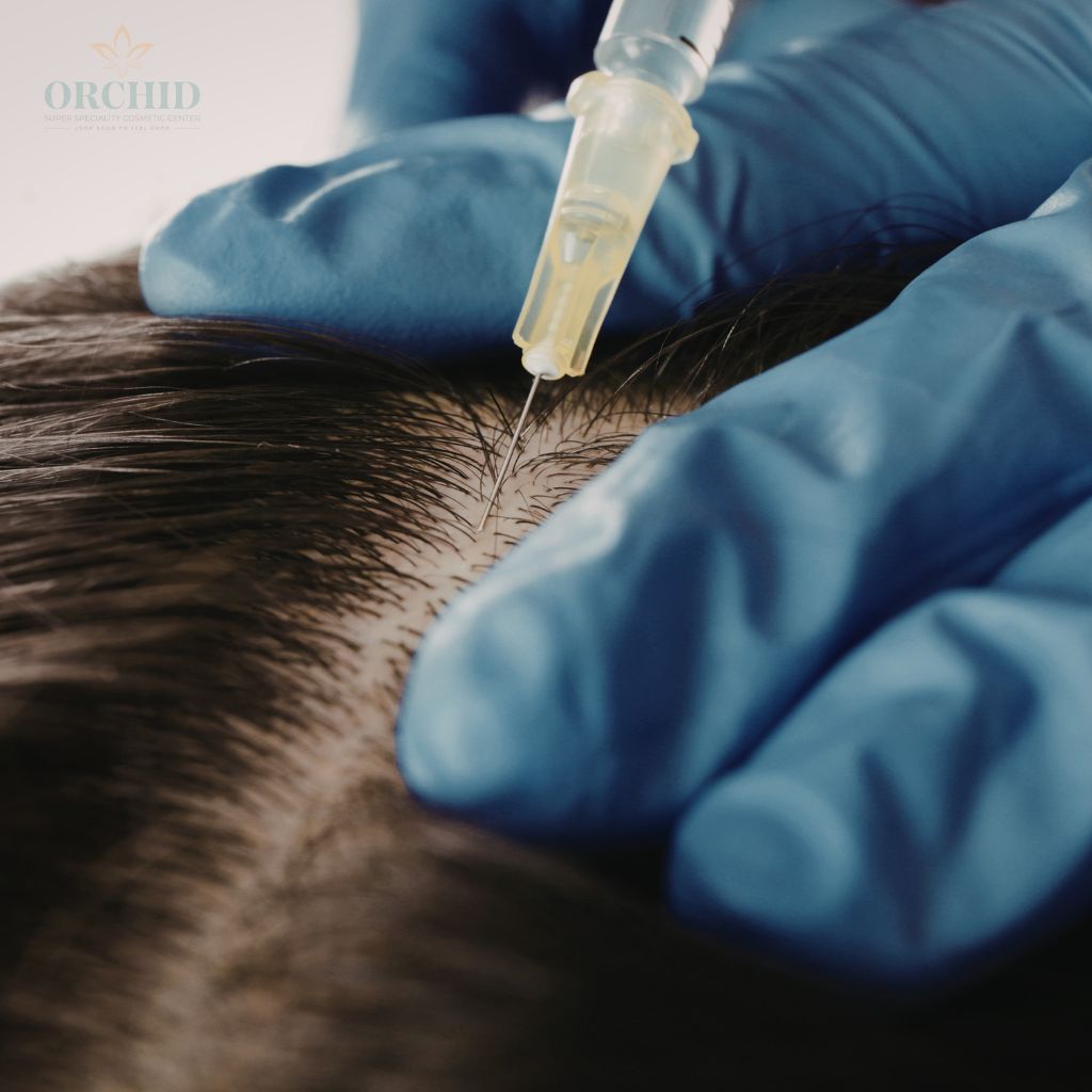 GFC & PRP Treatment
