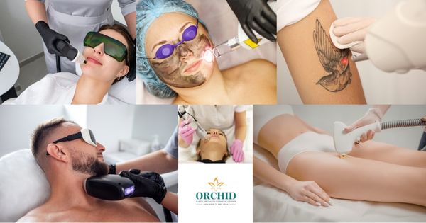 All Types of Laser Treatments in Kondapur, Hyderabad