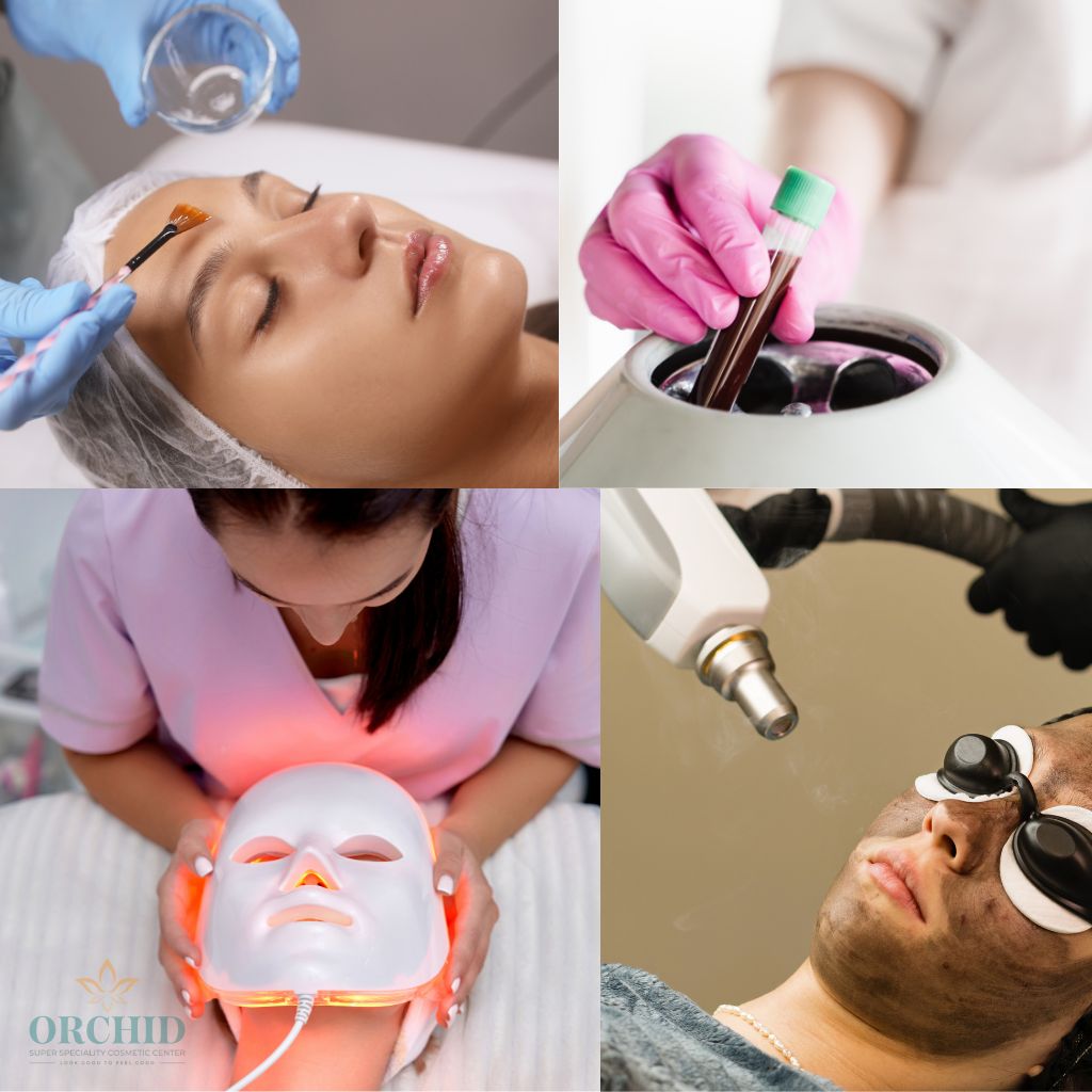Pimple & Acne Treatment in Kondapur at Orchid Cosmetic Clinic
