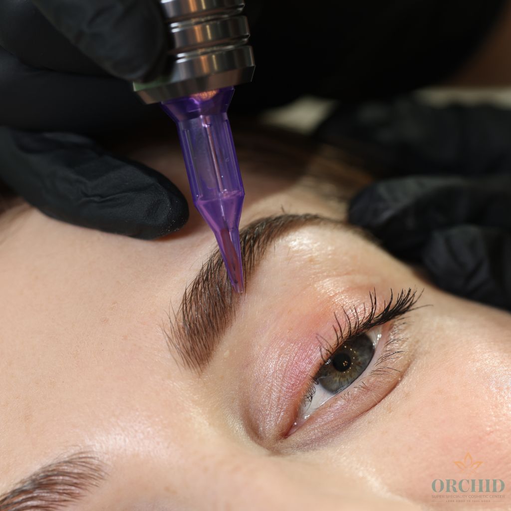 eyebrow pigmentation