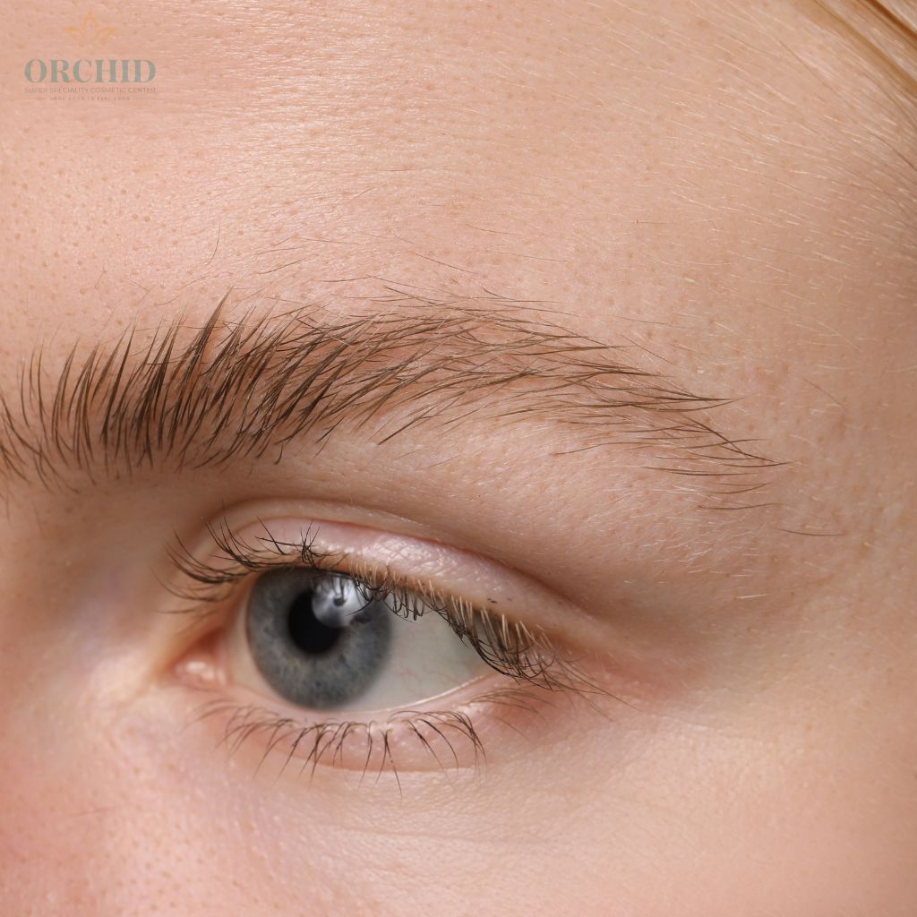eyebrow micropigmentation