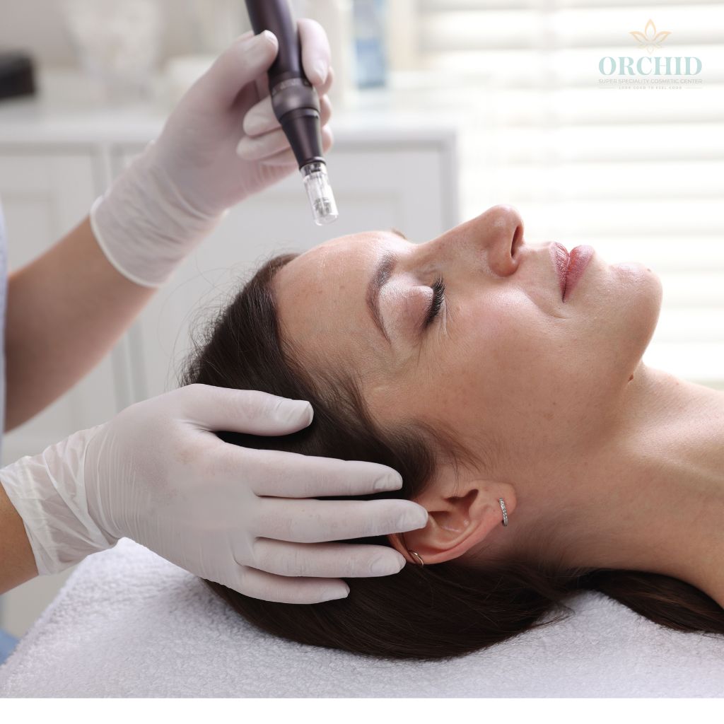 Face scars Removal in kondapur Orchid Clinic
