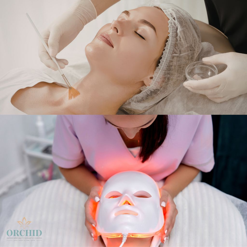hyperpigmentation treatment in Kondapur Orchid Clinic
