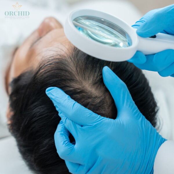 hair loss management
