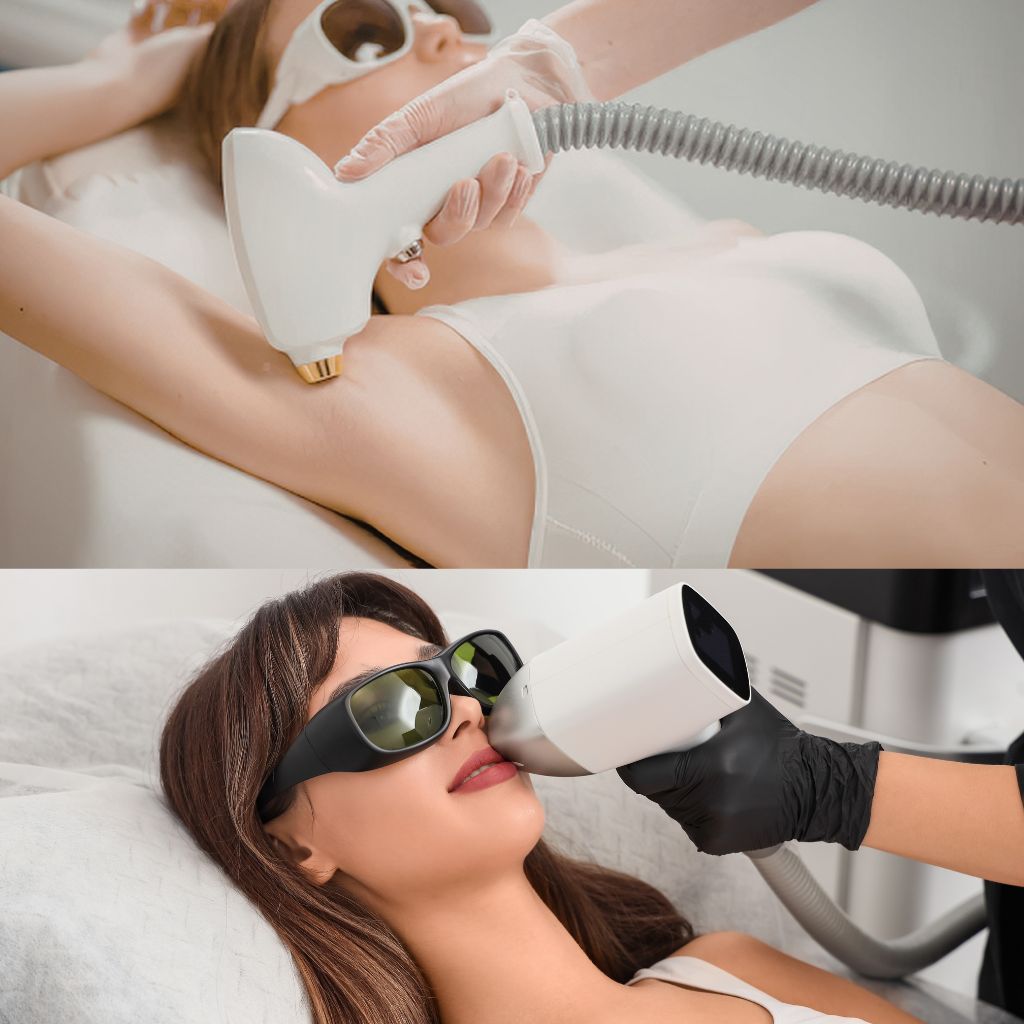 laser treatments