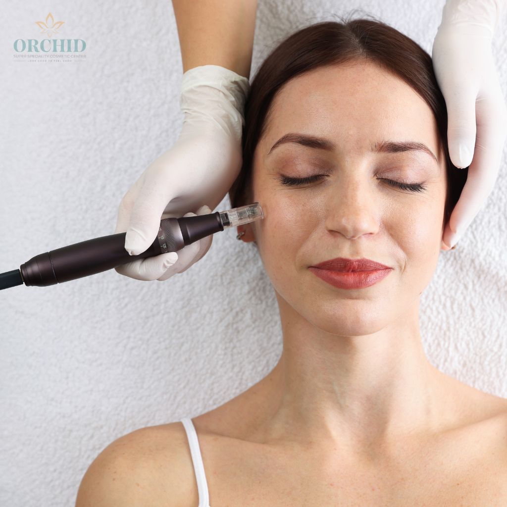 microneedling