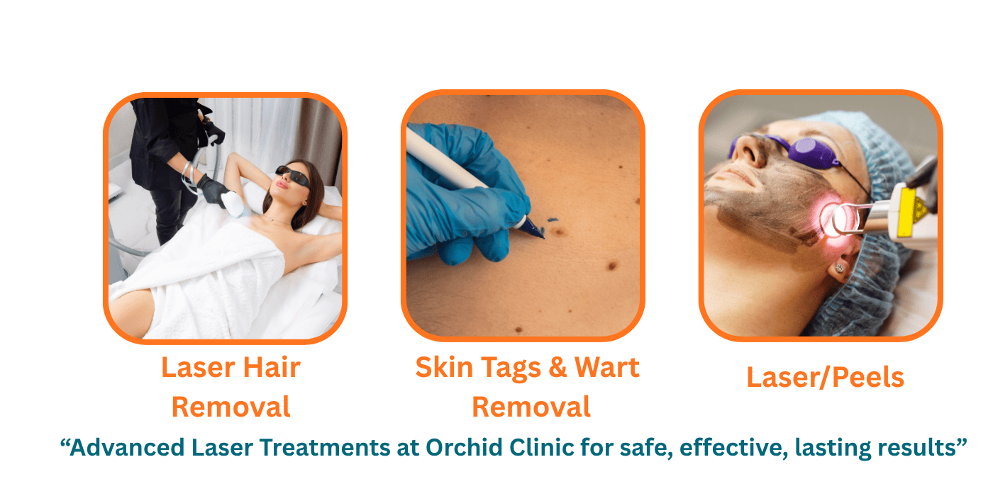 Laser Treatment